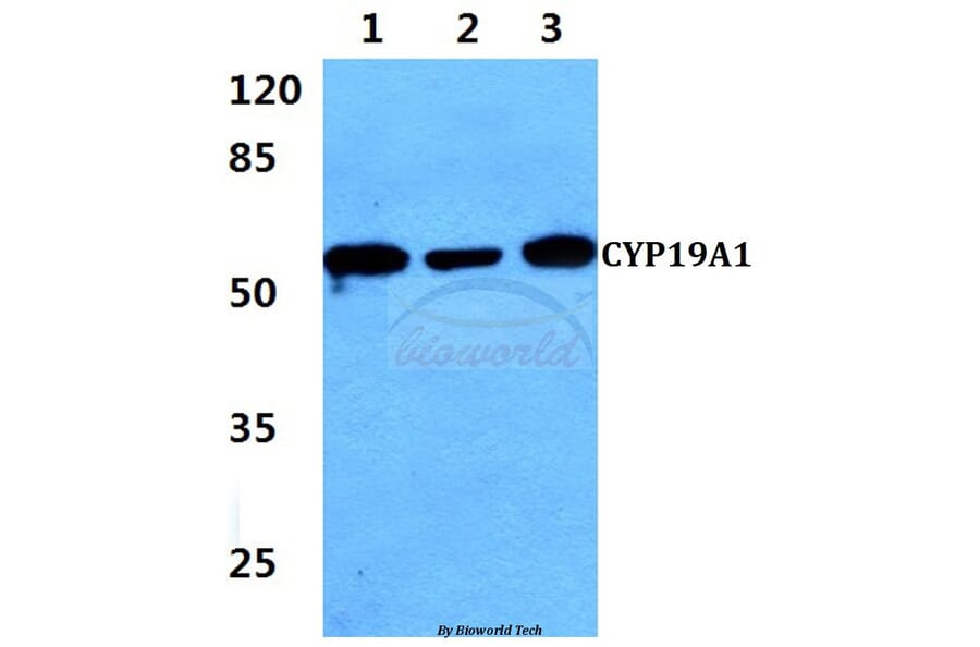 Anti-CYP19A1 (K243) Antibody from Bioworld Technology (BS2516) - Antibodies.com