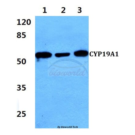 Anti-CYP19A1 (K243) Antibody from Bioworld Technology (BS2516) - Antibodies.com