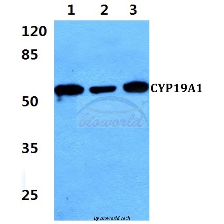 Anti-CYP19A1 (K243) Antibody from Bioworld Technology (BS2516) - Antibodies.com