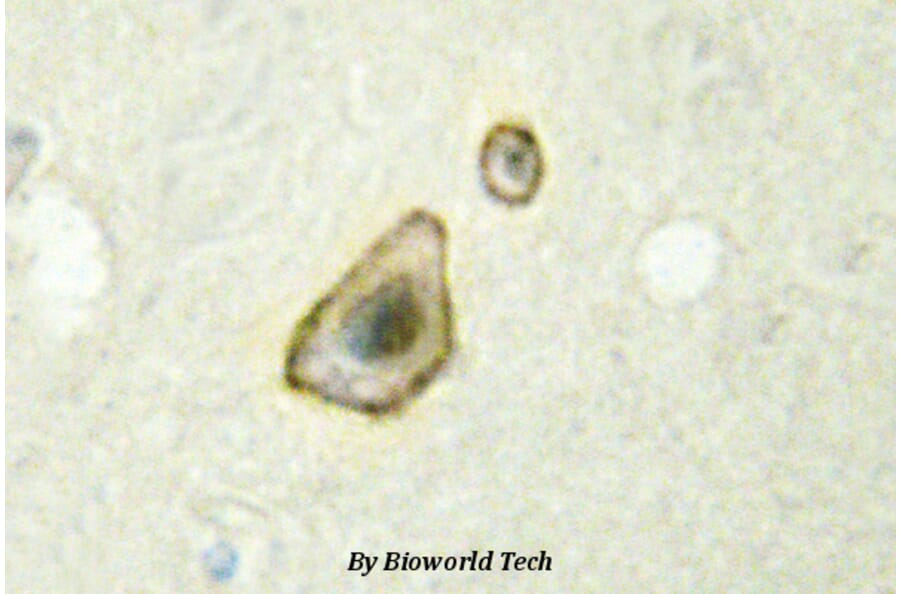 Anti-CYP19A1 (K243) Antibody from Bioworld Technology (BS2516) - Antibodies.com