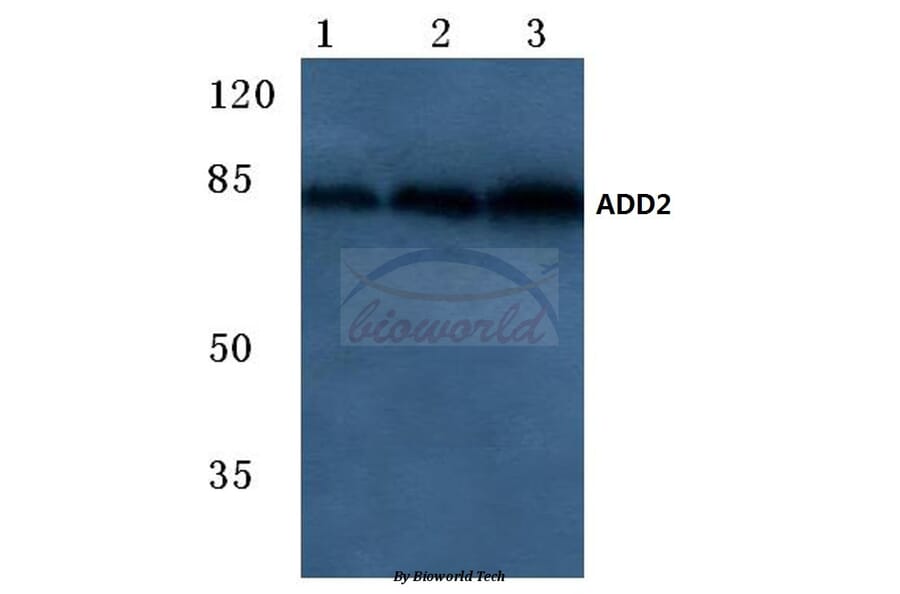 Anti-Adducin β (E497) Antibody from Bioworld Technology (BS2523) - Antibodies.com