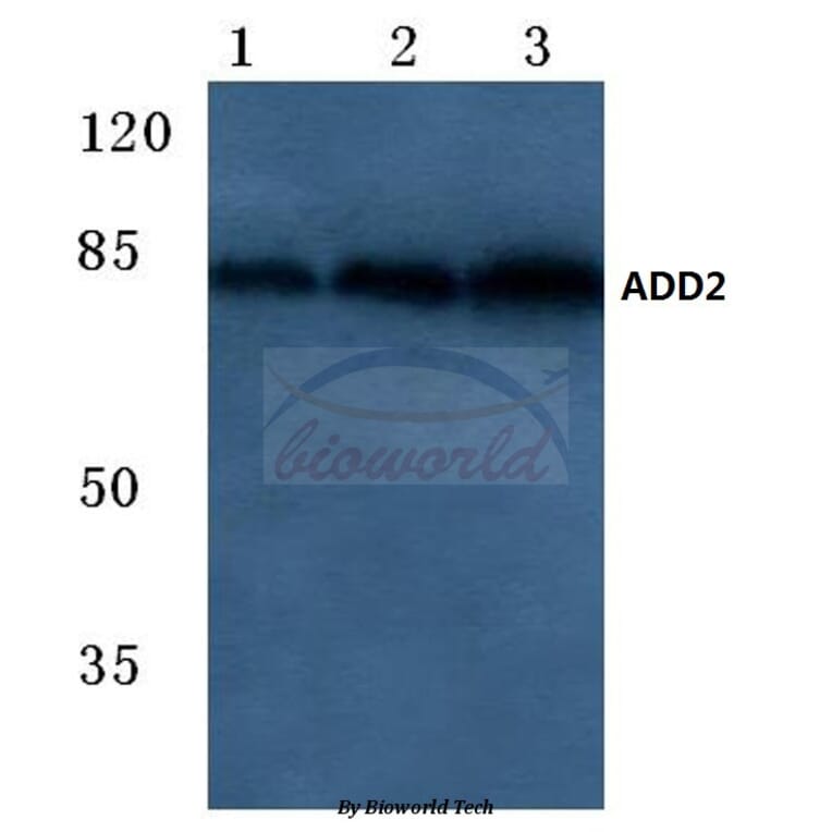 Anti-Adducin β (E497) Antibody from Bioworld Technology (BS2523) - Antibodies.com