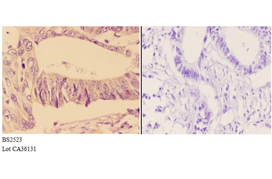 Anti-Adducin β (E497) Antibody from Bioworld Technology (BS2523) - Antibodies.com