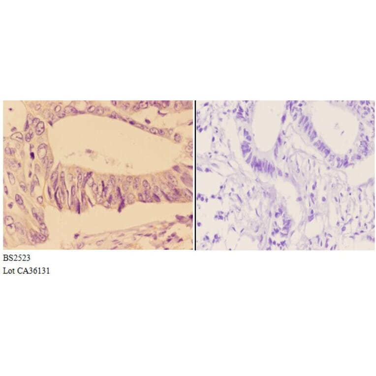 Anti-Adducin β (E497) Antibody from Bioworld Technology (BS2523) - Antibodies.com