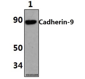 Anti-Cadherin-9 (P222) Antibody from Bioworld Technology (BS2526) - Antibodies.com