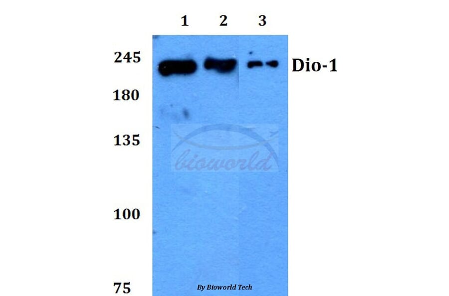 Anti-Dio-1 (S186) Antibody from Bioworld Technology (BS2533) - Antibodies.com