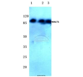 Anti-MALT1 (N324) Antibody from Bioworld Technology (BS2534) - Antibodies.com