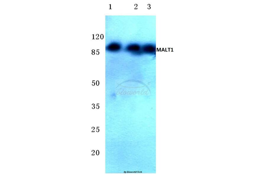 Anti-MALT1 (N324) Antibody from Bioworld Technology (BS2534) - Antibodies.com