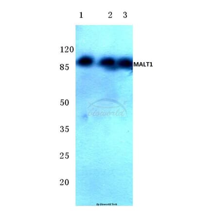 Anti-MALT1 (N324) Antibody from Bioworld Technology (BS2534) - Antibodies.com