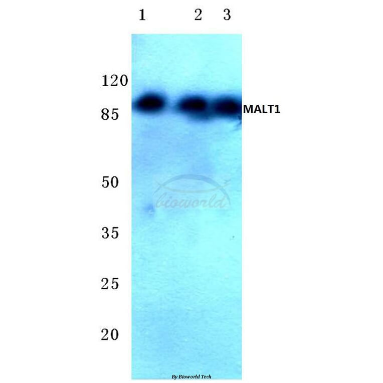 Anti-MALT1 (N324) Antibody from Bioworld Technology (BS2534) - Antibodies.com
