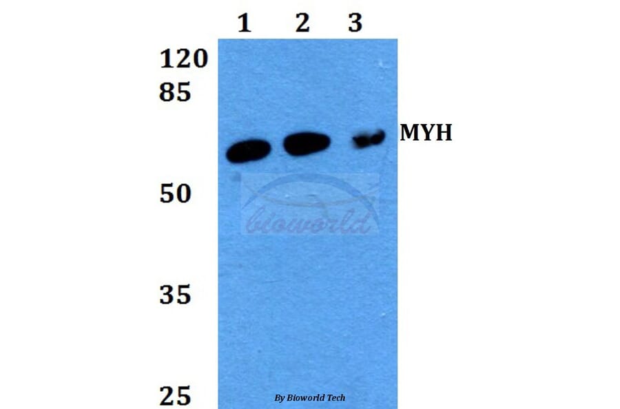 Anti-MYH (Y176) Antibody from Bioworld Technology (BS2535) - Antibodies.com
