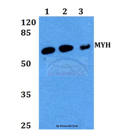 Anti-MYH (Y176) Antibody from Bioworld Technology (BS2535) - Antibodies.com
