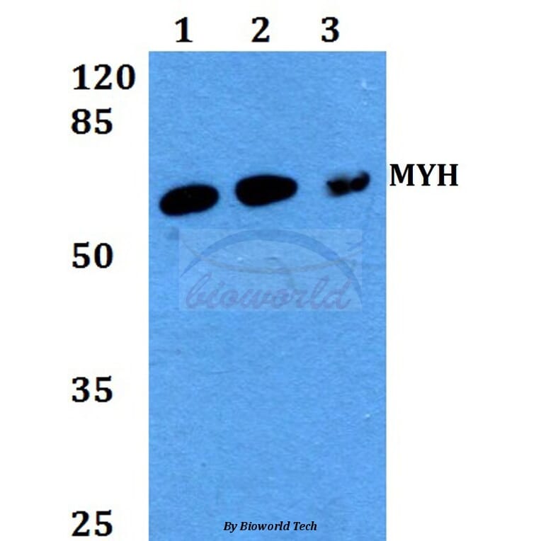 Anti-MYH (Y176) Antibody from Bioworld Technology (BS2535) - Antibodies.com