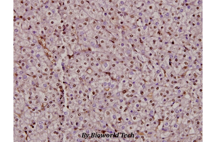 Anti-Bax (C62) Antibody from Bioworld Technology (BS2538) - Antibodies.com
