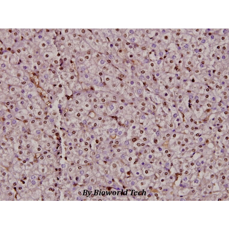 Anti-Bax (C62) Antibody from Bioworld Technology (BS2538) - Antibodies.com