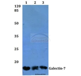 Anti-Galectin-7 (Q67) Antibody from Bioworld Technology (BS2539) - Antibodies.com