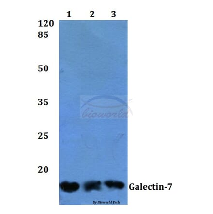Anti-Galectin-7 (Q67) Antibody from Bioworld Technology (BS2539) - Antibodies.com