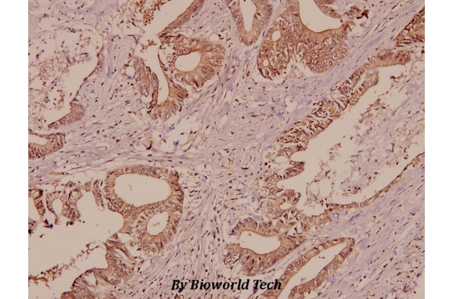 Anti-Galectin-7 (Q67) Antibody from Bioworld Technology (BS2539) - Antibodies.com