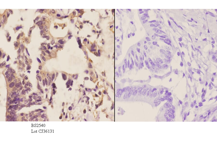 Anti-MGMT (C5) Antibody from Bioworld Technology (BS2540) - Antibodies.com