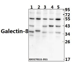 Anti-Galectin-8 (N82) Antibody from Bioworld Technology (BS2541) - Antibodies.com