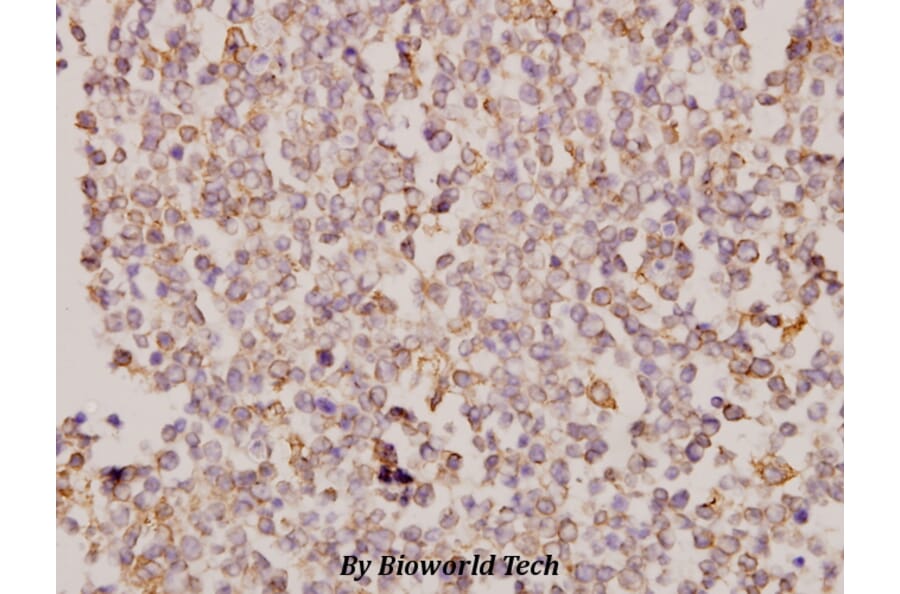 Anti-Galectin-8 (N82) Antibody from Bioworld Technology (BS2541) - Antibodies.com