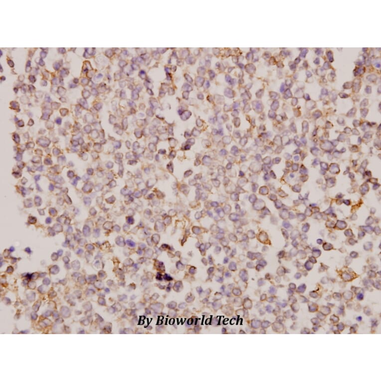 Anti-Galectin-8 (N82) Antibody from Bioworld Technology (BS2541) - Antibodies.com