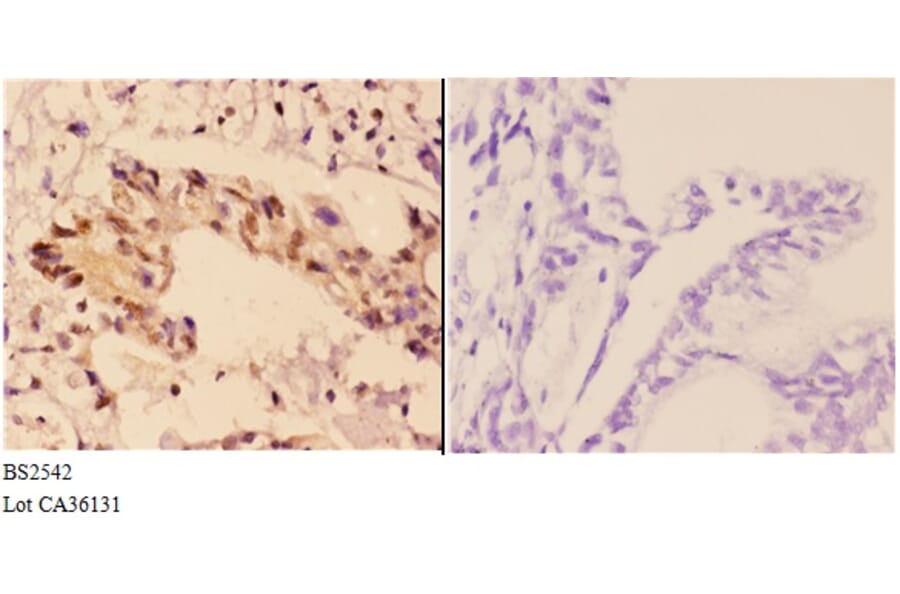 Anti-Rad51B (G226) Antibody from Bioworld Technology (BS2542) - Antibodies.com