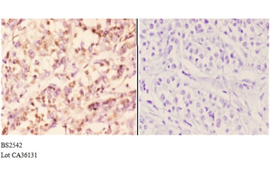 Anti-Rad51B (G226) Antibody from Bioworld Technology (BS2542) - Antibodies.com