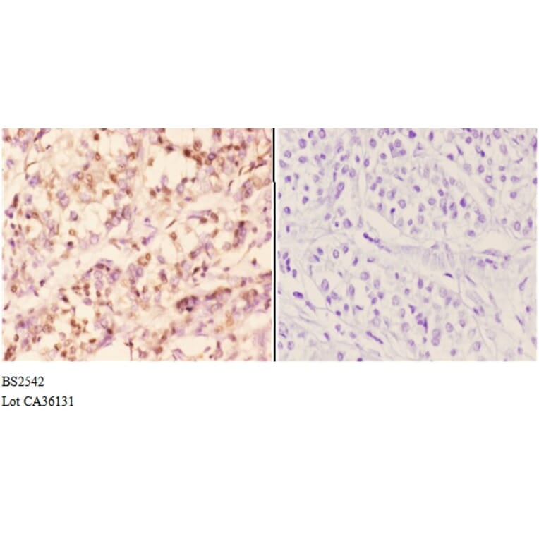 Anti-Rad51B (G226) Antibody from Bioworld Technology (BS2542) - Antibodies.com