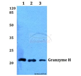 Anti-Granzyme H (G75) Antibody from Bioworld Technology (BS2543) - Antibodies.com
