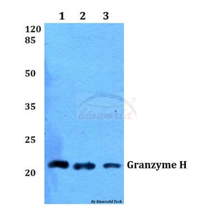 Anti-Granzyme H (G75) Antibody from Bioworld Technology (BS2543) - Antibodies.com