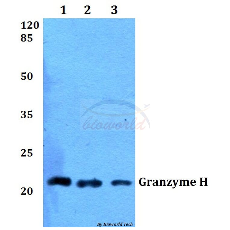 Anti-Granzyme H (G75) Antibody from Bioworld Technology (BS2543) - Antibodies.com