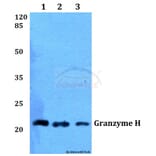 Anti-Granzyme H (G75) Antibody from Bioworld Technology (BS2543) - Antibodies.com