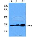 Anti-DcR3 (G287) Antibody from Bioworld Technology (BS2546) - Antibodies.com