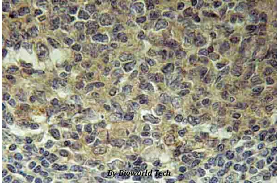 Anti-BLNK (N91) Antibody from Bioworld Technology (BS2547) - Antibodies.com