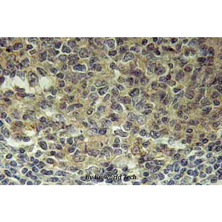 Anti-BLNK (N91) Antibody from Bioworld Technology (BS2547) - Antibodies.com