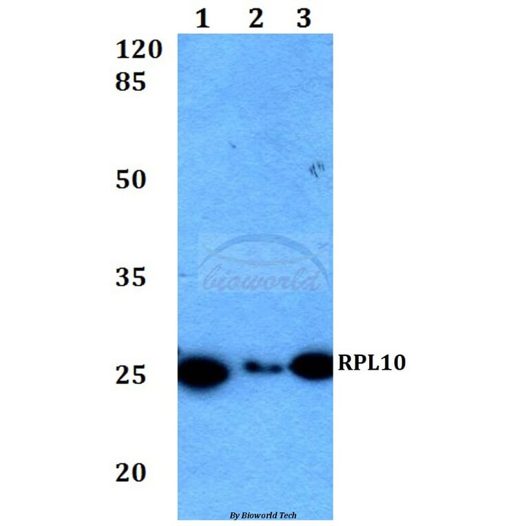 Anti-RPL10 (F34) Antibody from Bioworld Technology (BS2549) - Antibodies.com