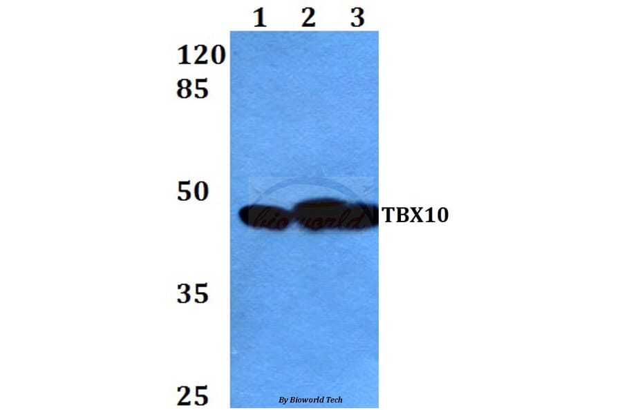 Anti-TBX10 (P291) Antibody from Bioworld Technology (BS2550) - Antibodies.com