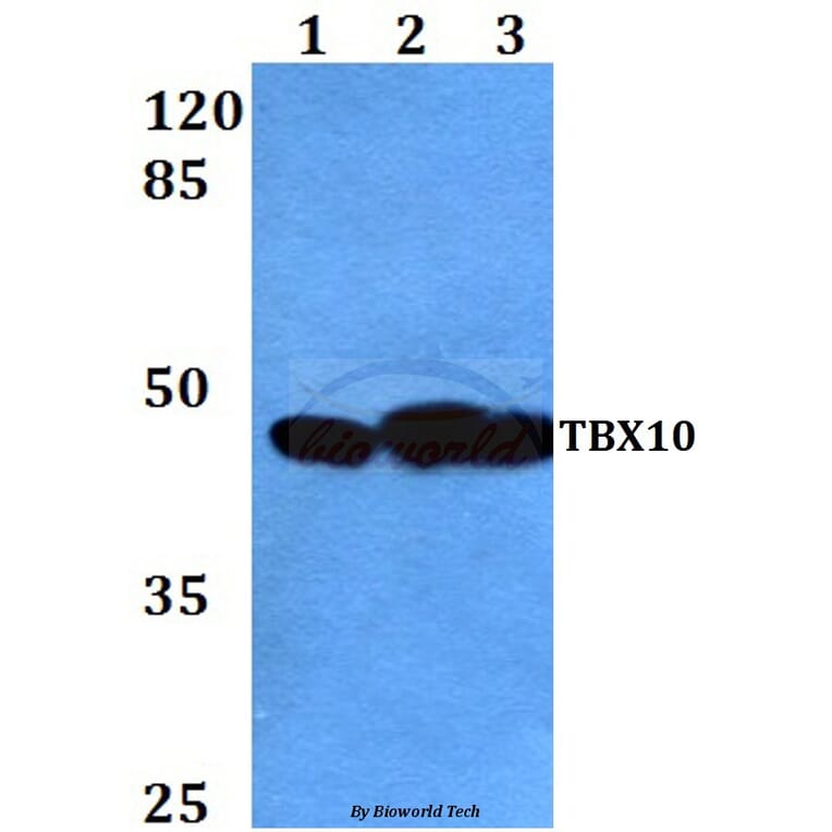 Anti-TBX10 (P291) Antibody from Bioworld Technology (BS2550) - Antibodies.com