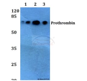 Anti-Prothrombin (G724) Antibody from Bioworld Technology (BS2552) - Antibodies.com