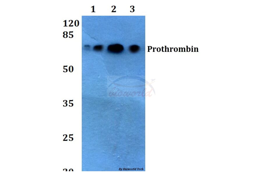 Anti-Prothrombin (G724) Antibody from Bioworld Technology (BS2552) - Antibodies.com