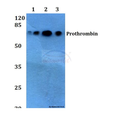 Anti-Prothrombin (G724) Antibody from Bioworld Technology (BS2552) - Antibodies.com