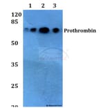 Anti-Prothrombin (G724) Antibody from Bioworld Technology (BS2552) - Antibodies.com
