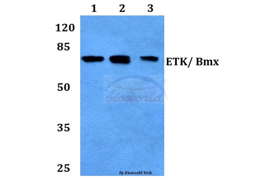 Anti-ETK (Y43) Antibody from Bioworld Technology (BS2557) - Antibodies.com