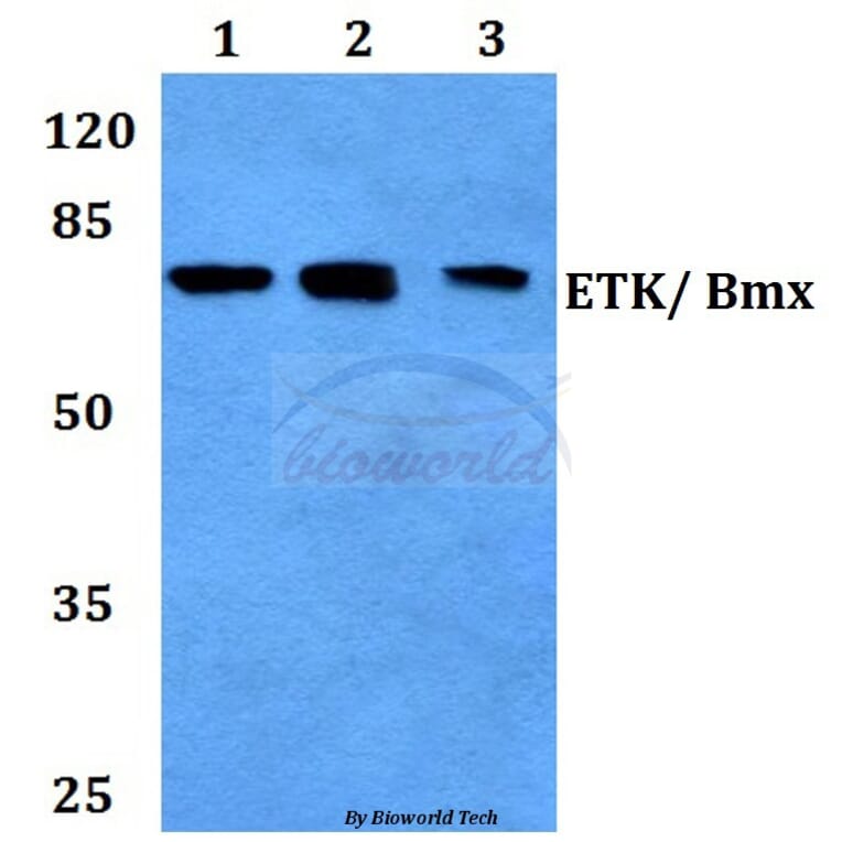 Anti-ETK (Y43) Antibody from Bioworld Technology (BS2557) - Antibodies.com