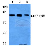 Anti-ETK (Y43) Antibody from Bioworld Technology (BS2557) - Antibodies.com
