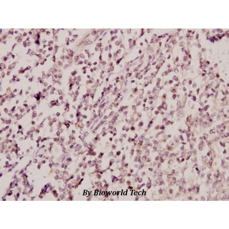 Anti-ETK (Y43) Antibody from Bioworld Technology (BS2557) - Antibodies.com