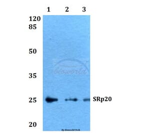 Anti-SRp20 (F151) Antibody from Bioworld Technology (BS2559) - Antibodies.com