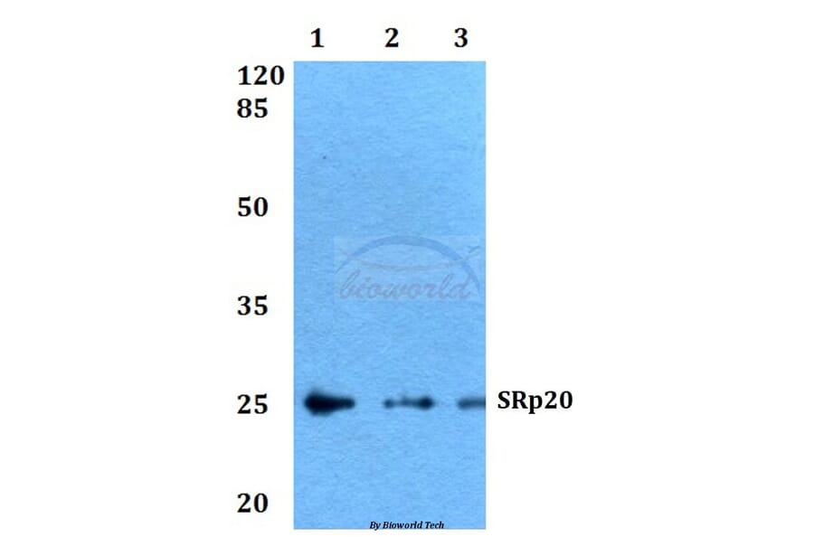 Anti-SRp20 (F151) Antibody from Bioworld Technology (BS2559) - Antibodies.com
