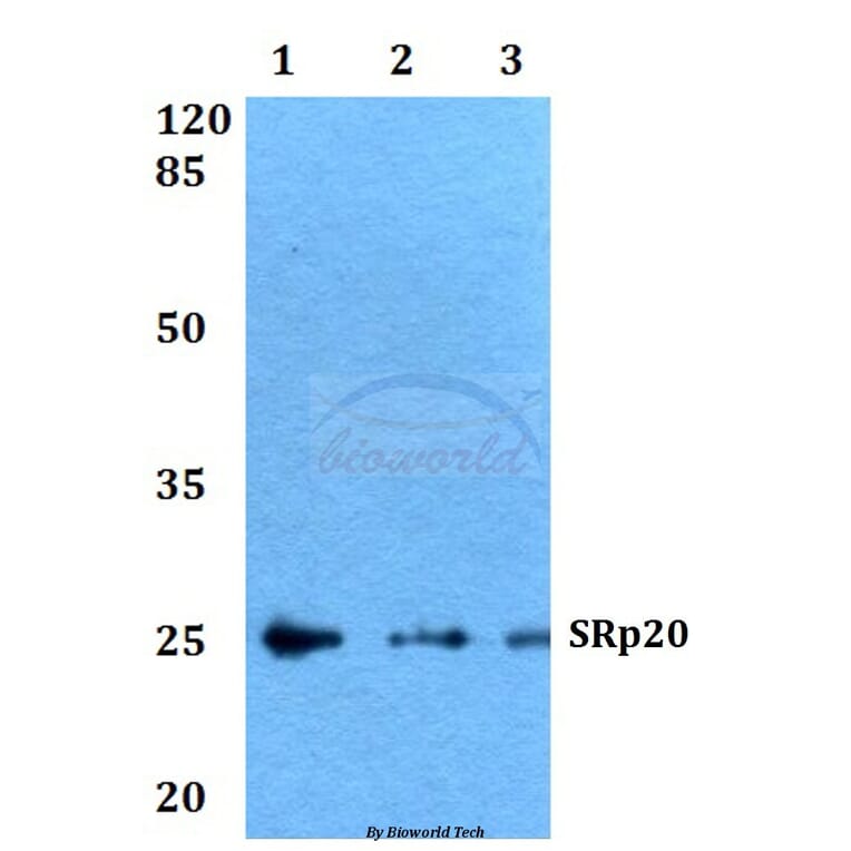 Anti-SRp20 (F151) Antibody from Bioworld Technology (BS2559) - Antibodies.com